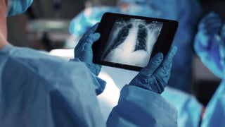 Individual in blue gloves presents a tablet featuring an X-ray image, highlighting the intersection of healthcare and technology.